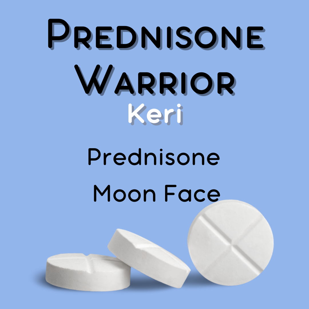 Prednisone Moon Face is Real