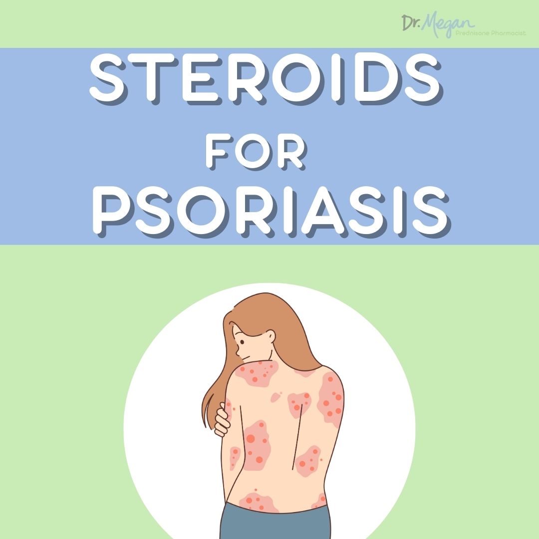 Steroids for Psoriasis