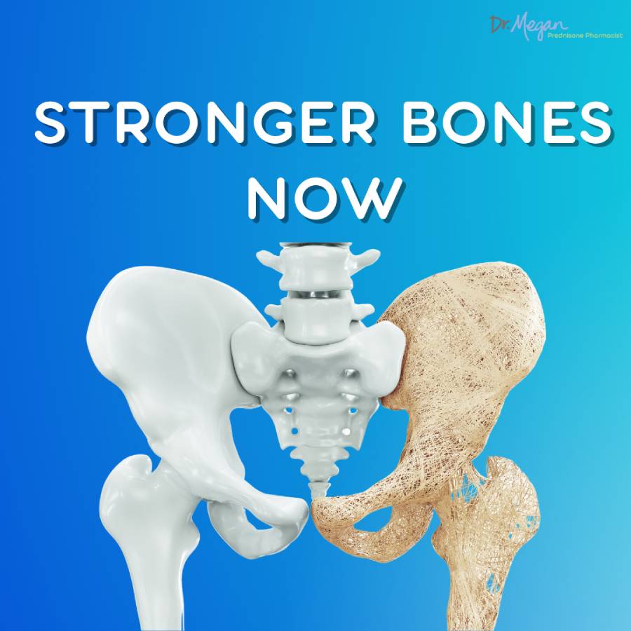 Stronger Bones Now – even on Prednisone