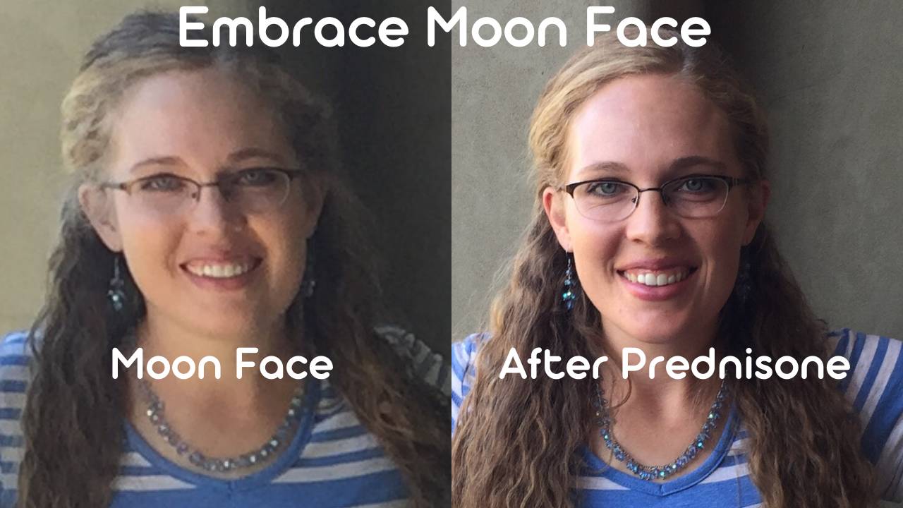 Embrace and Reduce Moon Face